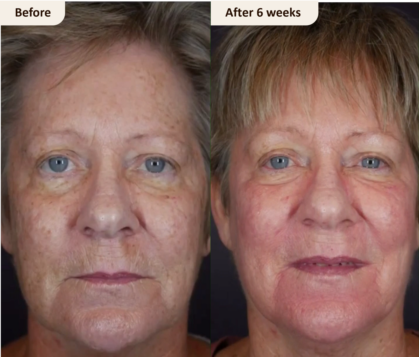 Opal™ Face Mask